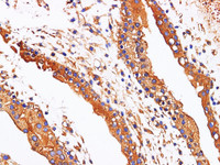 Immunohistochemistry of paraffin-embedded Human placenta using AFP Polyclonl Antibody at dilution of 1:200.