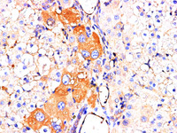 Immunohistochemistry of paraffin-embedded rat liver using AFP Polyclonl Antibody at dilution of 1:200.