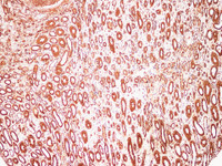 Immunohistochemistry of paraffin-embedded Human kidney using S100A9 Polyclonl Antibody at dilution of 1:200.