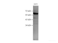 Western Blot analysis of A431 using c-SRC Polyclonl Antibody at dilution of 1:1000.