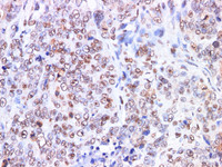 Immunohistochemistry of paraffin-embedded Human ovary using DNMT1 Polyclonl Antibody at dilution of 1:200.