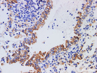 Immunohistochemistry of paraffin-embedded Mouse lung using CK-7 Polyclonl Antibody at dilution of 1:200.