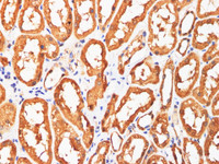 Immunohistochemistry of paraffin-embedded Human kidney using AFP Polyclonl Antibody at dilution of 1:200 (400×) .