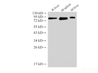 Western Blot analysis of Rat liver, Mouse spleen and Mouse liver using IL6R Polyclonal Antibody at dilution of 1:2000