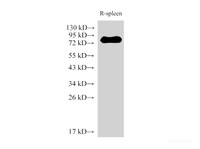 Western Blot analysis of Rat spleen using IL6R Polyclonal Antibody at dilution of 1:2000