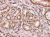 Immunohistochemistry of paraffin-embedded Human duodenum using S100A11 Polyclonal Antibody at dilution of 1:200