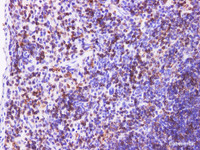 Immunohistochemistry of paraffin-embedded Mouse spleen using CD74 Polyclonal Antibody at dilution of 1:200