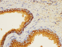 Immunohistochemistry of paraffin-embedded Human prostate using PSAP Ployclonal Antibody at dilution of 1:200.