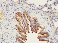 Immunohistochemistry of paraffin-embedded Rat lung using CD109 Ployclonal Antibody at dilution of 1:200.