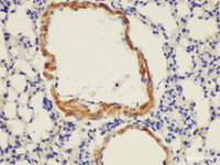 Immunohistochemistry of paraffin-embedded Mouse lung using ENG Ployclonal Antibody at dilution of 1:100.