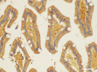 Immunohistochemistry of paraffin-embedded Human duodenum using ST14 Ployclonal Antibody at dilution of 1:200.