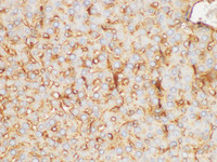 Immunohistochemistry of paraffin-embedded Rat liver using FGB Polycloanl Antibody at dilution of 1:200