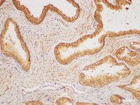 Immunohistochemistry of paraffin-embedded Human prostate gland using HRAS Polycloanl Antibody at dilution of 1:200