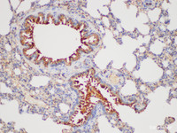 Immunohistochemistry of paraffin-embedded Rat lung using GSTP1 Polycloanl Antibody at dilution of 1:100