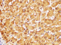 Immunohistochemistry of paraffin-embedded Human liver using GSTA1 Polycloanl Antibody at dilution of 1:50