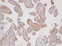 Immunohistochemistry of paraffin-embedded Human placenta using TGFB2 Polycloanl Antibody at dilution of 1:200