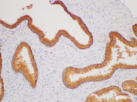 Immunohistochemistry of paraffin-embedded Human prostate using CD38 Polycloanl Antibody at dilution of 1:200