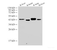 Western Blot analysis of 1) Rat liver, 2) Rat brain, 3) Rat lung, 4) Mouse liver using CD38 Polyclonal Antibody at dilution of 1:500