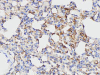 Immunohistochemistry of paraffin-embedded Rat lung using ANXA5 Polycloanl Antibody at dilution of 1:50