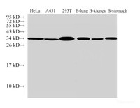 Western Blot analysis of 1) Hela, 2) A431, 3) 293T, 4) Bovine lung, 5) Bovine kidney, 6) Bovine stomach using ANXA5 Polyclonal Antibody at dilution of 1:500