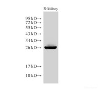 Western Blot analysis of Rat kidney using GSTA1 Polyclonal Antibody at dilution of 1:6000