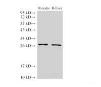 Western Blot analysis of Rat testis and Rat liver using GSTM2 Polyclonal Antibody at dilution of 1:500