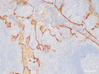 Immunohistochemistry of paraffin-embedded Human tonsil using SERPINB2 Polycloanl Antibody at dilution of 1:75