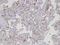 Immunohistochemistry of paraffin-embedded Human placenta using SERPINB2 Polycloanl Antibody at dilution of 1:75