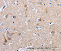 Immunohistochemistry of paraffin-embedded Human brain tissue using FN1 Polyclonal Antibody at dilution 1:50