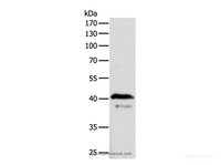 Western Blot analysis of Mouse brain tissue using ADAP1 Polyclonal Antibody at dilution of 1:500