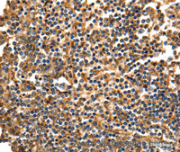 Immunohistochemistry of paraffin-embedded Human tonsil using ANXA5 Polyclonal Antibody at dilution of 1:40