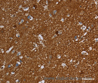 Immunohistochemistry of paraffin-embedded Human brain using SNCG Polyclonal Antibody at dilution of 1:60