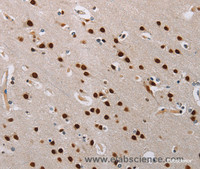 Immunohistochemistry of paraffin-embedded Human brain tissue using TONSL Polyclonal Antibody at dilution 1:60