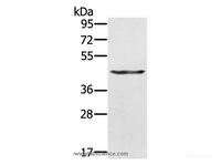 Western Blot analysis of A549 cell using KRT31 Polyclonal Antibody at dilution of 1:500