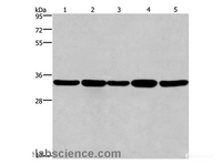 Western Blot analysis of LoVo and A549 cell, Human hepatocellular carcinoma tissue, Jurkat and Hela cell using E2F6 Polyclonal Antibody at dilution of 1:650