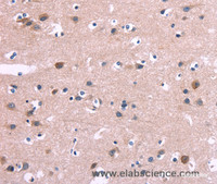 Immunohistochemistry of paraffin-embedded Human brain tissue using DUSP13 Polyclonal Antibody at dilution 1:60