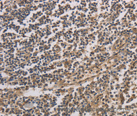 Immunohistochemistry of paraffin-embedded Human tonsil tissue using HSF1 Polyclonal Antibody at dilution 1:60