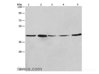 Western Blot analysis of A549, NIH/3T3 and 293T cell，Human hepatocellular carcinoma tissue and hela cell using RPSA Polyclonal Antibody at dilution of 1:425