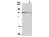 Western Blot analysis of A375 and A431 cell using SH-PTP1 Polyclonal Antibody at dilution of 1:500