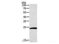Western Blot analysis of Hela cell using SNAP25 Polyclonal Antibody at dilution of 1:400