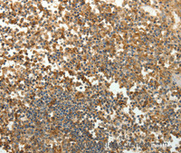 Immunohistochemistry of paraffin-embedded Human tonsil tissue using SFTPD Polyclonal Antibody at dilution 1:30