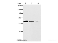 Western Blot analysis of NIH/3T3 and SKOV3 cell, Human ovarian cancer tissue using ABCE1 Polyclonal Antibody at dilution of 1:450