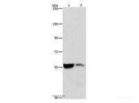 Western Blot analysis of Mouse liver and kidney tissue using ALDH8A1 Polyclonal Antibody at dilution of 1:550