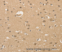 Immunohistochemistry of paraffin-embedded Human brain using ALDH8A1 Polyclonal Antibody at dilution of 1:30