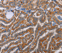 Immunohistochemistry of paraffin-embedded Human brain tissue using ALG9 Polyclonal Antibody at dilution 1:60