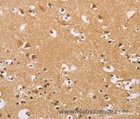 Immunohistochemistry of paraffin-embedded Human brain tissue using ARHGEF1 Polyclonal Antibody at dilution 1:50