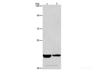 Western Blot analysis of Hela and A431 cell using CSNK1E Polyclonal Antibody at dilution of 1:1550