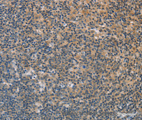 Immunohistochemistry of paraffin-embedded Human tonsil using FXYD1 Polyclonal Antibody at dilution of 1:60