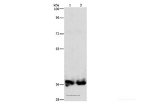 Western Blot analysis of Mouse kidney and Human fetal kidney tissue using ASPA Polyclonal Antibody at dilution of 1:1400