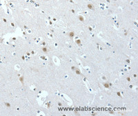 Immunohistochemistry of paraffin-embedded Human brain tissue using ACLY Polyclonal Antibody at dilution 1:40